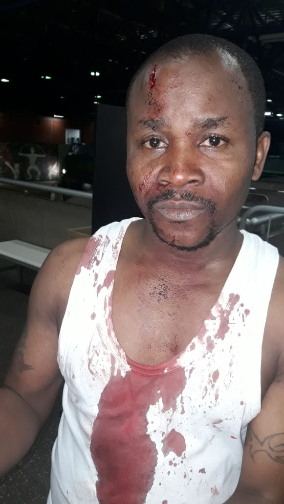 Owolabi beaten bloody and blue in Brazil