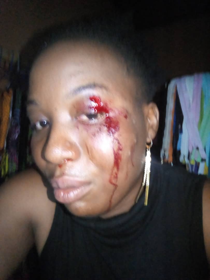 Assault Victim, Ngodoo Akula