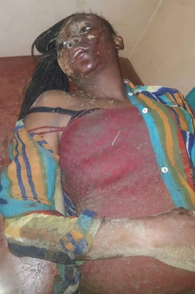 Battered and bruised: Temitope Mustapha after she was rescued from the mob