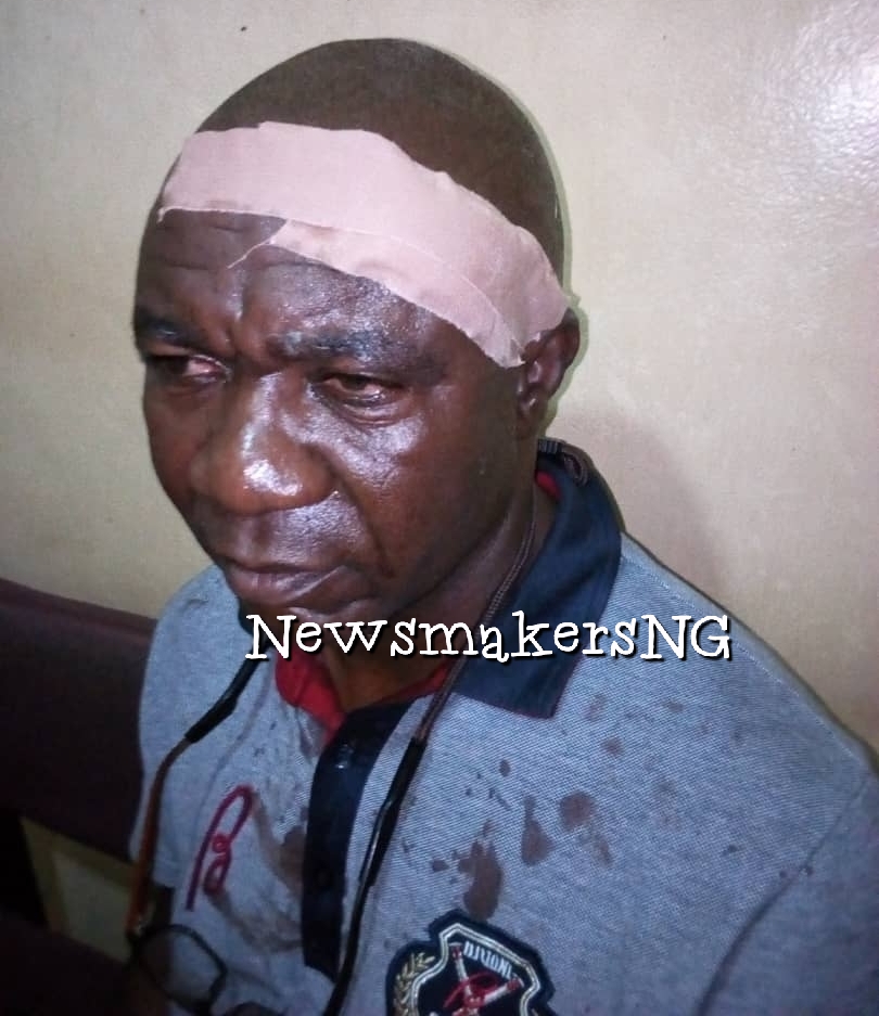 Lucky Escape, Emmanuel Oladesu on his hospital bed with the injured head bandaged today